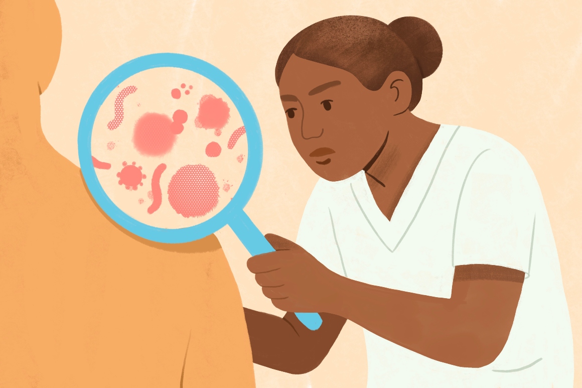 Illustratie van verpleegkundige die de huid bekijkt met een vergrootglas