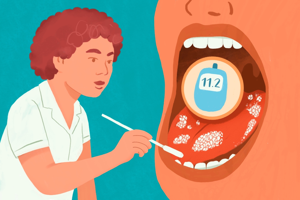 diabetes congres candida bij diabetes.